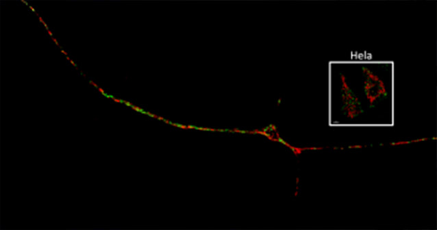 Tiled image of a single neuron compared to HeLa cells