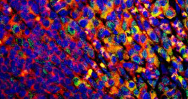 Epifluorescent image of intestinal tissue-derived cells