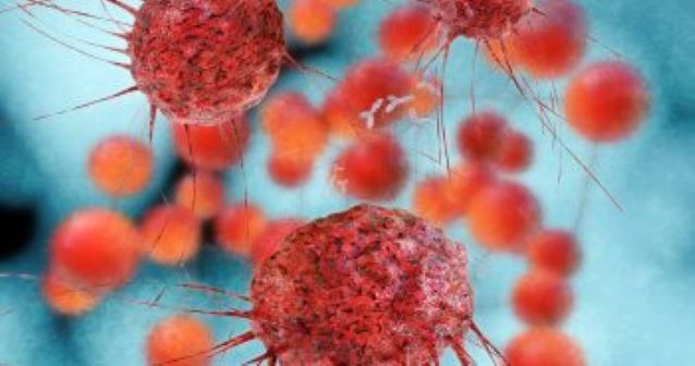 Ovarian Cancer Cells Illustration