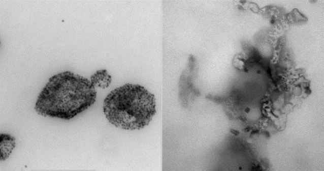 Iron nanoparticles under microscope