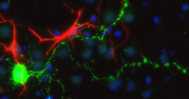 proteins on neuron Illustration