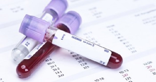 blood samples in vial