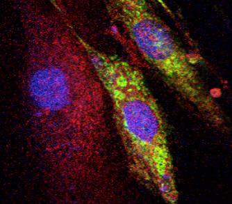 Colocalization of TSC2 on the lysosome image