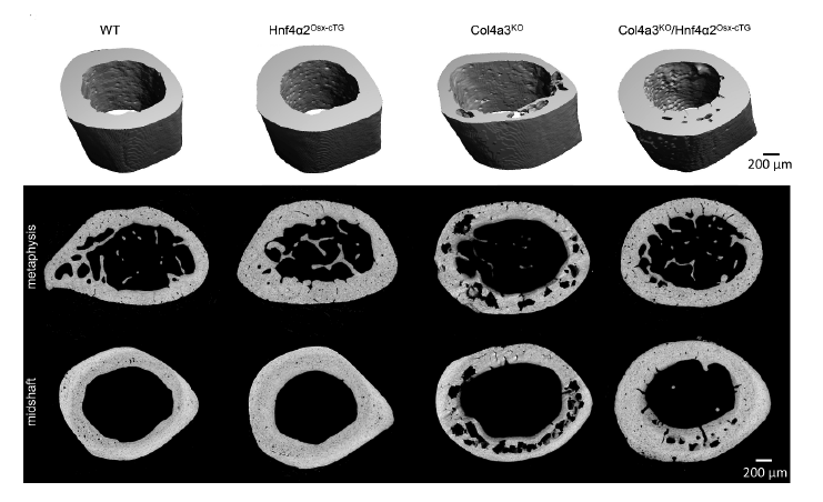 femur bone images showing bone loss