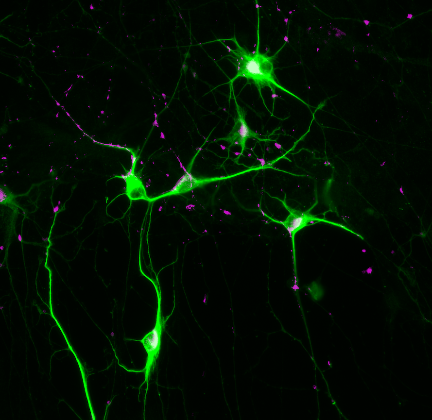Representative image of neuronal markers MAP2 (green) and Syn1 (magenta) 