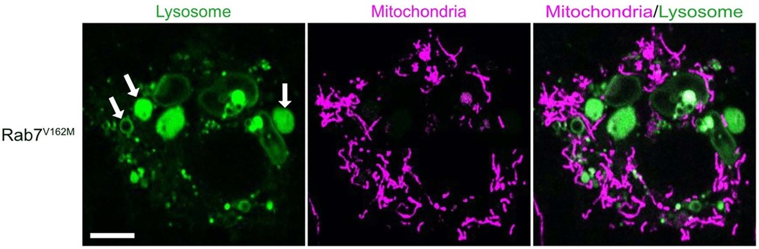 Confocal live microscopy image of mitochondria (MitoTracker/purple) and lysosomes