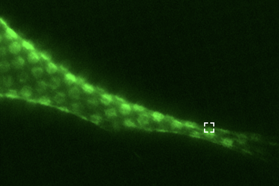 Fluorescence image of a MEF cell protrusion