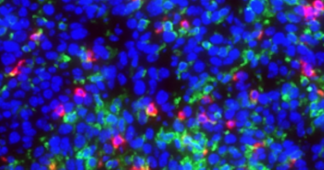 inhibited tumor-associated myeloid cells’ illustration