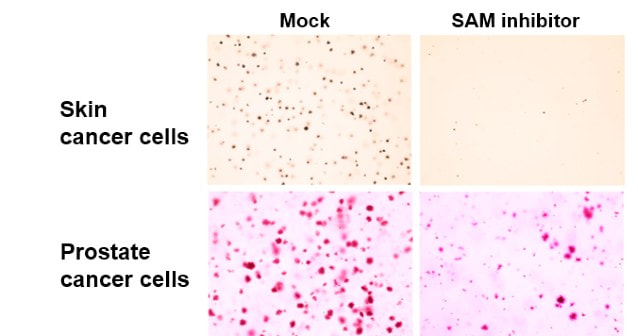 Microscopic image cells and SAM inhibitor