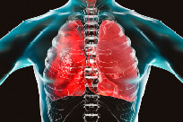 Pulmonary illustration of lungs