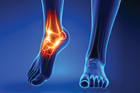 Rehabilitation illustration of injured ankle