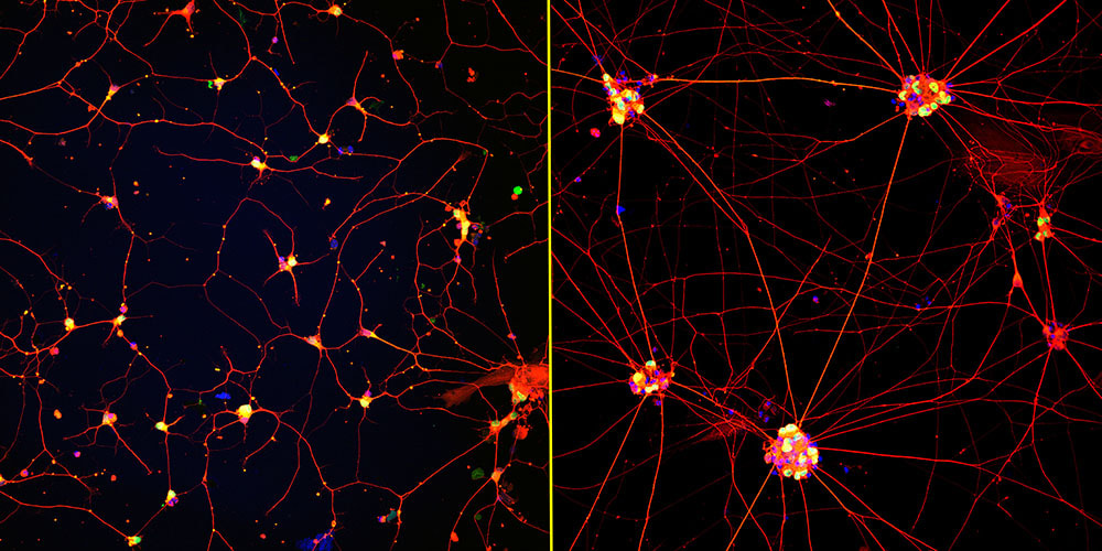 Fluorescent images of human neurons (stained with red, green and blue) 