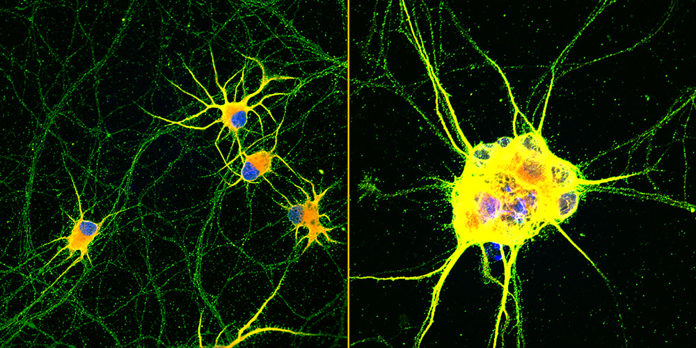 Fluorescent images of human neurons 