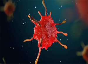 Medical illustration of tumor cell