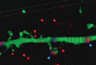 3D image of a neuron (green) and the protein CNTNAP2 floating away from the neuron.
