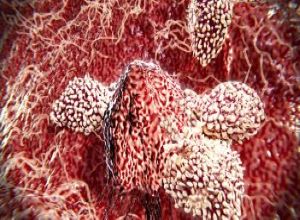 Utilizing B-Cells to Promote Glioblastoma Immunity